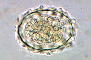 Mikropräparat - Ascaris lumbricoides, Eier im Stuhl