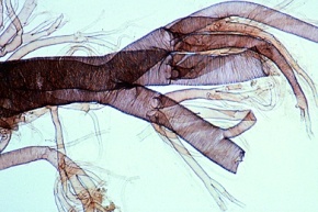Mikropräparat - Tracheen vom Insekt, Verzweigte Atemröhren mit spiraliger Wandverstärkung