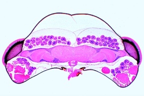 Mikropräparat - Apis mellifica, Honigbiene, Kopf mit Facettenaugen und Gehirn, quer