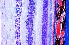 Mikropräparat - Netzhaut, Retina, vom Säugetier, quer