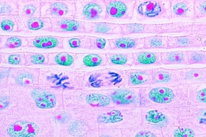 Mikropräparat - DNA-RNA-Färbung in Zellen der Zwiebelwurzelspitze