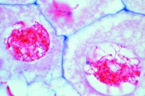 Mikropräparat - Lilie, Pollenentwicklung, Meiose, junge Prophase