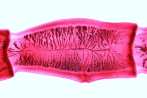 Mikropräparat - Bandwurm, Taenia, reife Proglottide