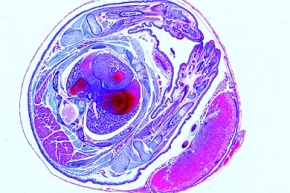 Mikropräparat - Maus, Uterus mit Embryo und Placenta, quer