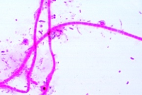 Mikropräparat - Abwasserbakterien (Sphaerotilus), flockenbildende Bakterien mit Schleimhüllen