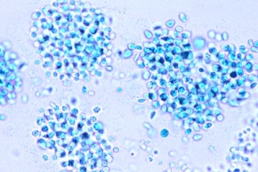 Mikropräparat - Wasserblüte (Microcystis), Blaualge in Massenvermehrung