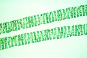 Mikropräparat - Grünalge (Spirogyra), Bildung von Algenwatten in eutrophen Gewässern