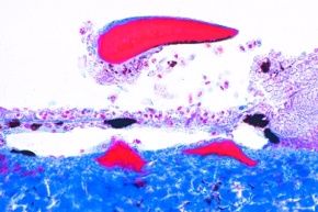 Mikropräparat - Durch Chemieabwässer geschädigte Haut eines Fisches