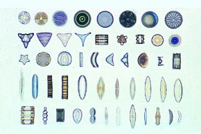 Mikropräparat - Diatomeen (Kieselalgen). Streupräparat mit vielen Formen