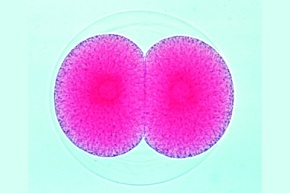 Mikropräparat - Seeigel, Zwei-Zellen-Stadium