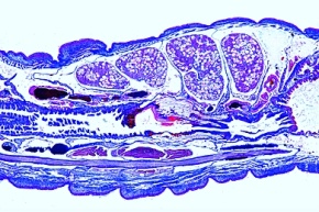 Mikropräparat - Regenwurm, Geschlechtsregion mit Samenblasen und Gonaden, sagittal (9. - 16. Segment)