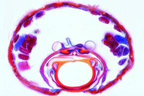 Mikropräparat - Culex pipiens, Stechmücke, Querschnitt durch die Mundwerkzeuge des Weibchens