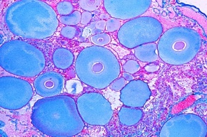 Mikropräparat - Flußkrebs, Ovarium quer. Eientwicklung in verschiedenen Stadien
