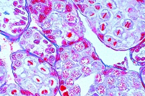 Mikropräparat - Flußkrebs, Hoden quer, Spermiogenese, Teilungsstadien