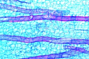 Mikropräparat - Löwenzahn, Wurzel mit Milchröhren, längs