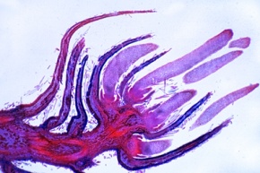 Mikropräparat - Haselnuß (Corylus avellana), weibliche Blüte, längs