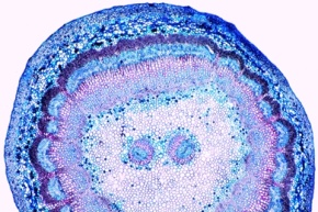 Mikropräparat - Roßkastanie (Aesculus hippocast.), Blattstiel (Petiole), quer