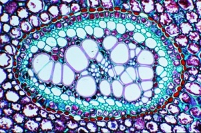 Mikropräparat - Polystele, Rhizom von Pteridium, quer, Konzentrisches Leitbündel mit Innenxylem