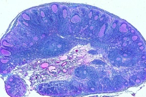 Mikropräparat - Lymphknoten des Menschen, quer, Lymphocyten