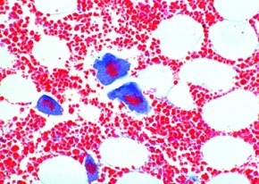 Mikropräparat - Rotes Knochenmark, Rippe des Menschen, quer, Giemsafärbung zur Darstellung der Blutbildung