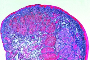 Mikropräparat - Lippe, Embryo vom Mensch, quer