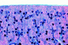 Mikropräparat - Niere des Schweines, quer, injiziert zur Darstellung der Blutgefäße