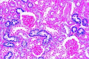 Mikropräparat - Niere der Maus, quer, Darstellung der Speicherungsfunktion durch Vitalfärbung mit Trypanblau