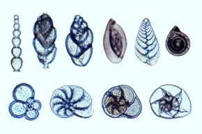 Mikropräparat - Foraminifera, Kammertierchen, viele verschiedene Formen