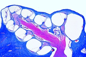 Mikropräparat - Ohr der Ratte längs, Mittel- und Innenohr, Gehörgang