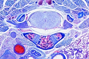 Mikropräparat - Rückenmark mit Wirbelkörper, Ratte, quer