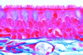 Mikropräparat - Flimmerepithel in der Trachea, Mensch, quer