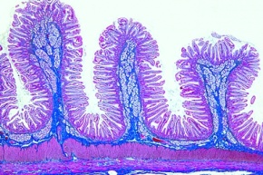 Mikropräparat - Samenblasendrüse (Gl, vesiculosa), quer