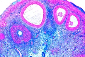 Mikropräparat - Eierstock (Ovarium), quer