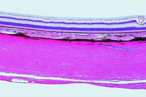 Mikropräparat - Netzhaut (Retina), quer