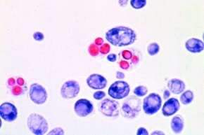 Mikropräparat - Hefezellen in Sprossung, Saccharomyces