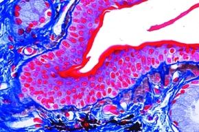 Mikropräparat - Haut und Organe einer Salamanderlarve, quer, Zellteilungen in verschiedenen Stadien (Mitosen)