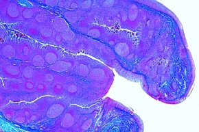 Mikropräparat - Gaumenmandel (Tonsilla palatina), Mensch, quer