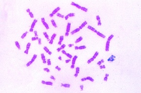 Mikropräparat - Chromosomen, männlich, aus Blutkultur