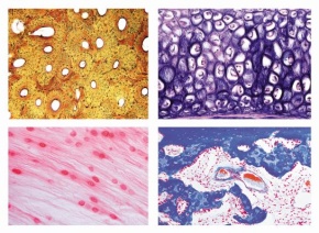 Histologie, Knorpel und Knochen, 11 Mikropräparate, Mit ausführl