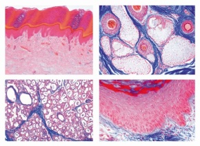 Mikropräparate in Serie - Histologie, Haut