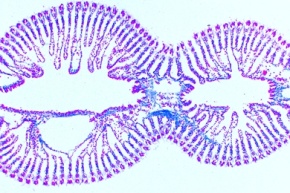 Mikropräparat - Klaffmuschel, Mya arenaria, Kiemen quer und längs