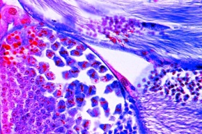 Mikropräparat - Heuschrecke, Hoden, quer. Spermatogenese mit zahlreichen Meiose und Mitose-Stadien