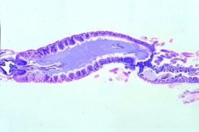 Mikropräparat - Heuschrecke, Gomphocerus, Darm und Malpighische Gefäße, quer