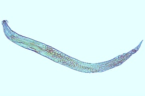 Mikropräparat - Enterobius vermicularis (Oxyuris), Madenwurm, total