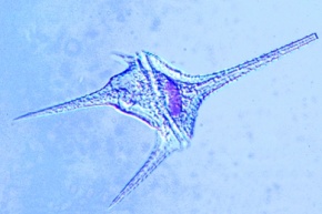 Mikropräparat - Ceratium hirundinella, Dinoflagellat aus dem Süßwasser, total