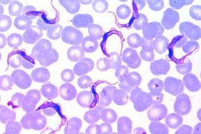 Mikropräparat - Trypanosoma gambiense, Erreger der Schlafkrankheit, Blutausstrich