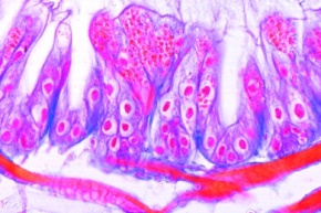 Mikropräparat - Nosema apis, Erreger der Bienenruhr, Darm einer erkrankten Biene quer