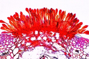 Mikropräparat - Getreiderost. Puccinia graminis, Teleutosporen auf Weizenhalm, quer (Schwarzer Rost)