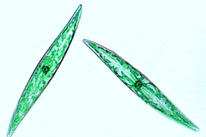 Mikropräparat - Kieselalgen, Diatomeen, mit Zellinhalt