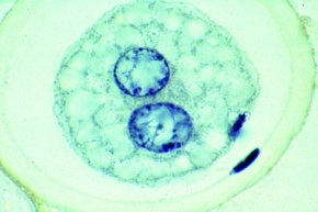 Mikropräparat - Ascaris, männlicher und weiblicher Vorkern in befruchteten Eizellen